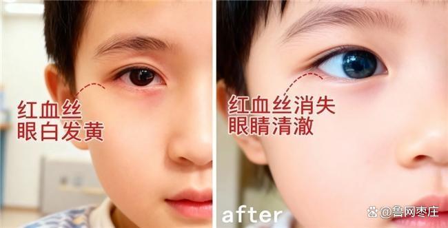 哪个品牌的叶黄素含量高？测评叶黄素十大品牌数据说话(图10)