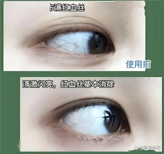 哪个品牌的叶黄素含量高？测评叶黄素十大品牌数据说话(图12)