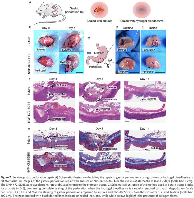 AdvMater：用于增强组织愈合的水凝胶黏合剂模块化设计(图7)